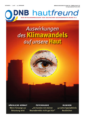 Deutscher Neurodermitis Bund e.V. Anzeige