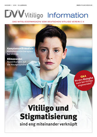 Deutscher Vitiligo Verein e.V. Anzeige
